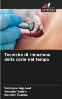 Tecniche di rimozione della carie nel tempo