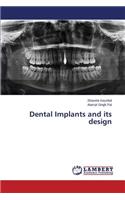 Dental Implants and Its Design