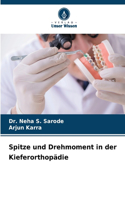 Spitze und Drehmoment in der Kieferorthopädie