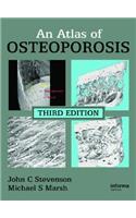 Atlas of Osteoporosis