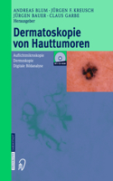 Dermatoskopie Von Hauttumoren: Auflichtmikroskopie - Dermoskopie - Digitale Bildanalyse