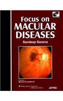 Focus on Macular Diseases