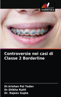 Controversie nei casi di Classe 2 Borderline