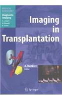 Imaging in Transplantation
