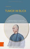 Tumor im Blick