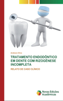 Tratamento Endodôntico Em Dente Com Rizogênese Incompleta
