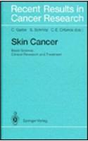 Skin Cancer