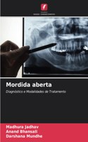 Mordida aberta