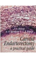 Carotid Endarterectomy
