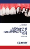 Intraradicular Rehabilitation of Endodontically Treated Teeth