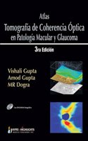 Atlas - Tomografia de Coherencia Optica En Patologia Macular y Glaucoma