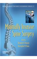 Minimally Invasive Spine Surgery
