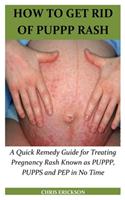 How to Get Rid of Puppp Rash