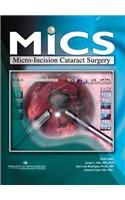 MICS Micro-Incision Cataract Surgery with CD-ROM