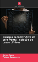 Cirurgia reconstrutiva do seio frontal: seleção de casos clínicos