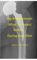 Hip Replacement: What To Expect Before, During and After