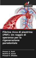 Fibrina ricca di piastrine (PRF)