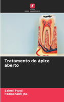Tratamento do ápice aberto