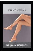 Varicose Veins