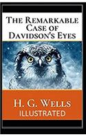 The Remarkable Case of Davidsons Eyes Illustrated