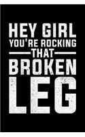 Hey Girl You're Rocking That Broken Leg