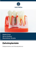 Zahnimplantate