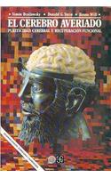 El Cerebro Averiado