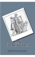 On Fractures