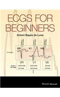 Ecgs for Beginners