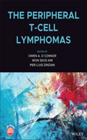 Peripheral T-Cell Lymphomas
