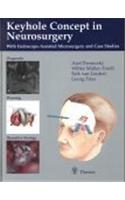 The Keyhole Concept in Neurosurgery