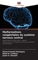 Malformations congénitales du système nerveux central