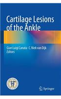 Cartilage Lesions of the Ankle