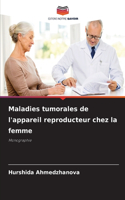 Maladies tumorales de l'appareil reproducteur chez la femme