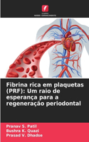 Fibrina rica em plaquetas (PRF)