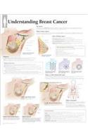 Understanding Breast Cancer Wall Chart