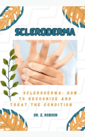 Scleroderma: Scleroderma: How to Recognize and Treat the Condition