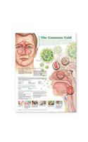 Understanding the Common Cold Anatomical Chart
