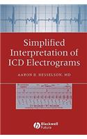 Simplified Interpretation of ICD Electrograms