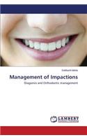 Management of Impactions
