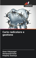 Carie radicolare e gestione