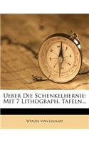 Ueber Die Schenkelhernie.