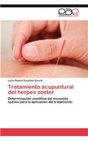 Tratamiento Acupuntural del Herpes Zoster