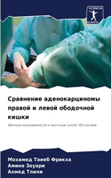 Сравнение аденокарциномы правой и левой о