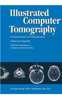 Illustrated Computer Tomography