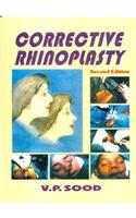 Corrective Rhinoplastry