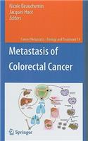 Metastasis of Colorectal Cancer