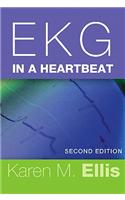 EKG in a Heartbeat