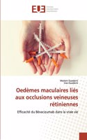 Oedèmes maculaires liés aux occlusions veineuses rétiniennes