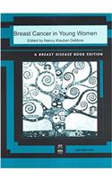 Breast Cancer in Young Women